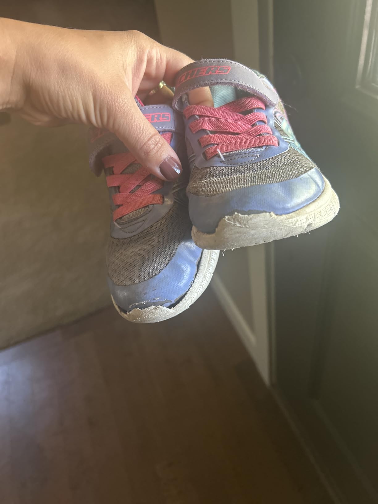 Image from a customer review showing durability issues with the toe of the Skechers shoe peeling back.